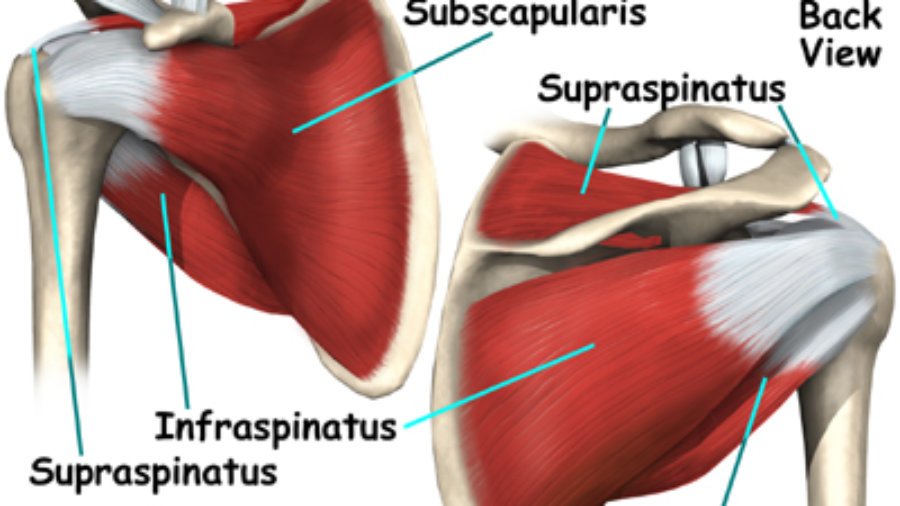 rotatorcuff